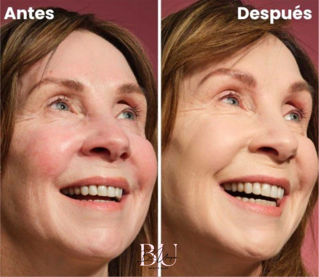 https://cdn.shopify.com/s/files/1/0858/6264/6108/files/Antes_y_Despues_EDITADA.png?v=1742414830