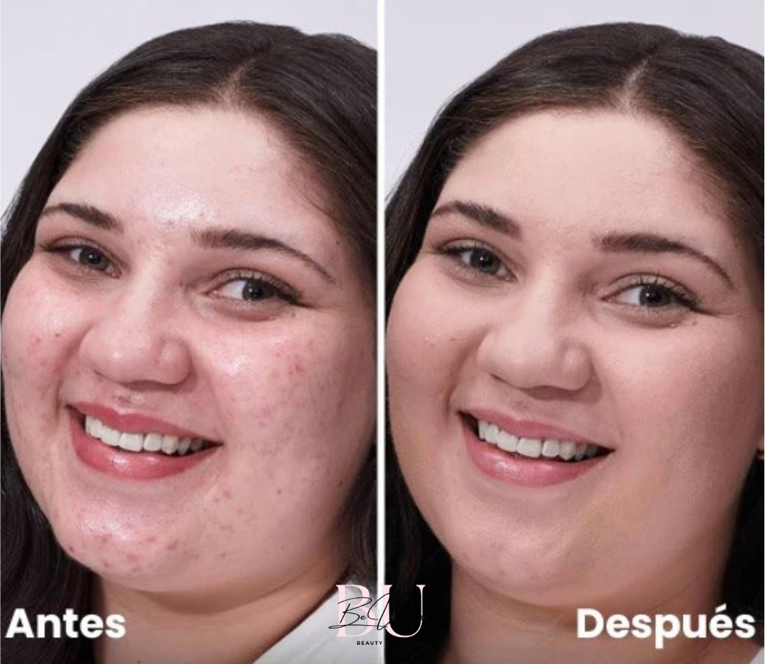https://cdn.shopify.com/s/files/1/0858/6264/6108/files/Antes_y_Despues_EDITADA_2_a12d14d6-7e80-46a1-921b-91b9e47a1fd0.png?v=1742414830