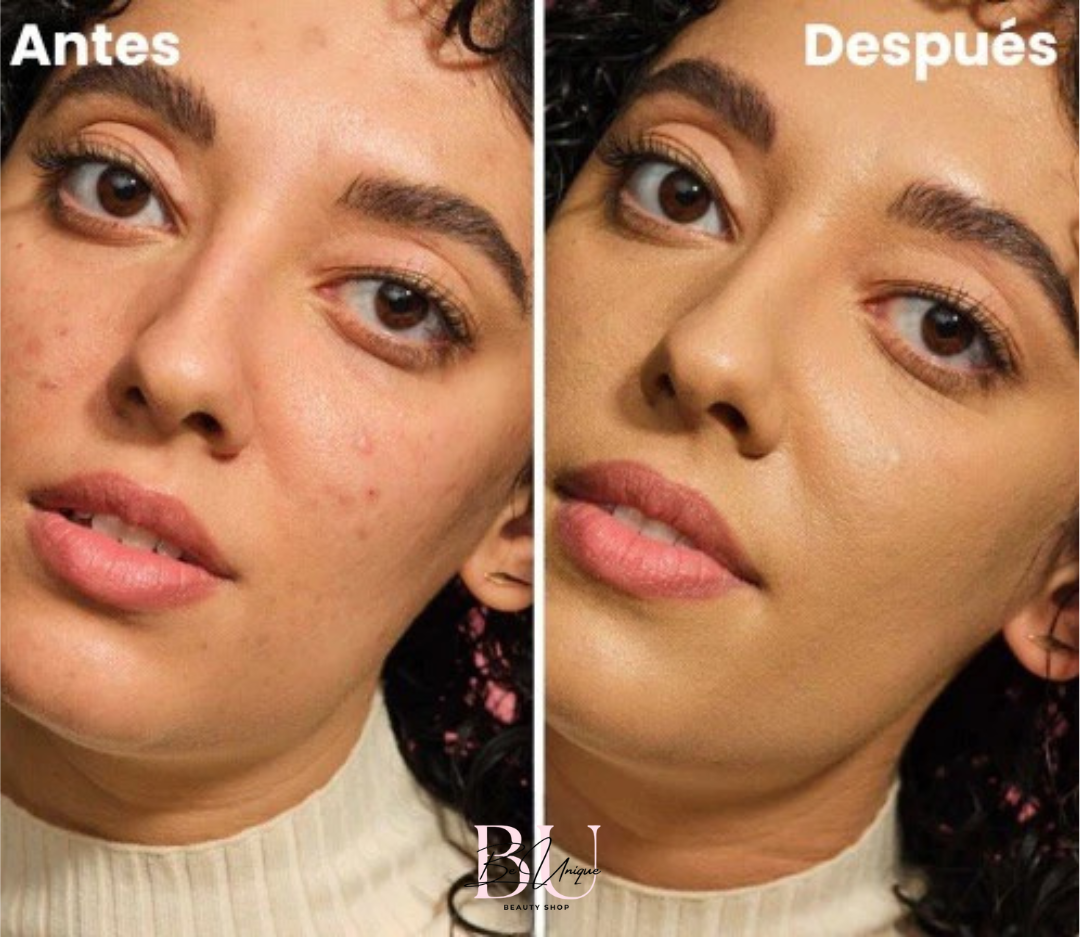 https://cdn.shopify.com/s/files/1/0858/6264/6108/files/Antes_y_Despues_EDITADA_3_3ea1a43f-5f69-45ad-8afe-a0805a6b18de.png?v=1742414830
