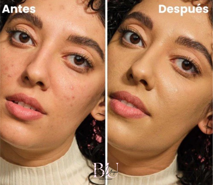 https://cdn.shopify.com/s/files/1/0858/6264/6108/files/Antes_y_Despues_EDITADA_3_3ea1a43f-5f69-45ad-8afe-a0805a6b18de.png?v=1742414830